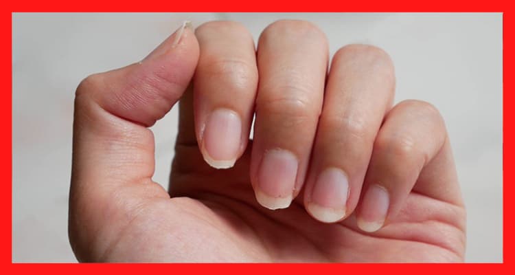 Diseños de uñas ¡1.000 ideas en imágenes! 157 Fortalecer las Uñas Quebradizas4