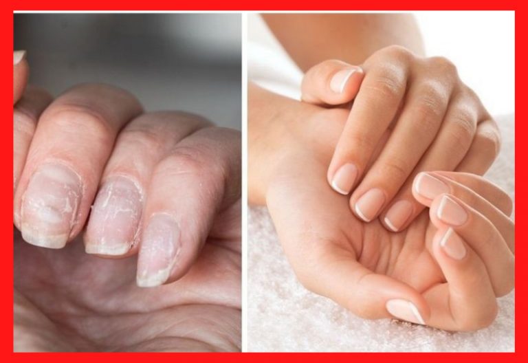 Diseños de uñas ¡1.000 ideas en imágenes! 96 Uñas Saludables después de los Acrílicos